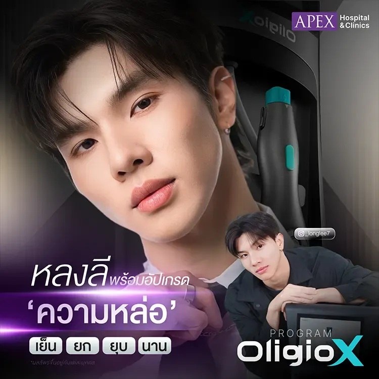 Oligio X ยกกระชับแบบจัดเต็ม (คุณหลงลี - หลงซื่อ ลี)