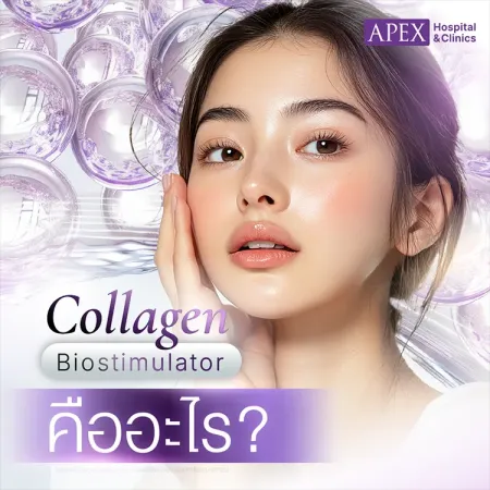 Collagen Biostimulator คืออะไร ต่างจากฉีดฟิลเลอร์อย่างไร