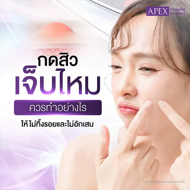 กดสิวดีไหม เจ็บไหม สิวแบบไหนกดได้ไม่ได้ กี่วันรอยถึงหาย