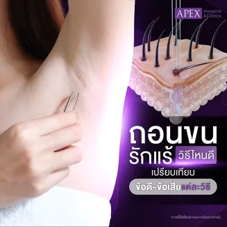 วิธีถอนขนรักแร้ มีกี่วิธี ข้อดีข้อเสีย แตกต่างกันอย่างไร