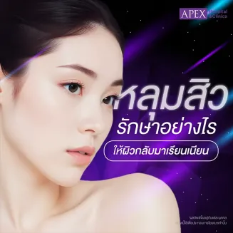 หลุมสิว เกิดจากสาเหตุอะไร มีวิธีการรักษารอยหลุมสิวอย่างไร