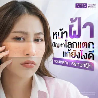 ฝ้า (Melasma) เกิดจากสาเหตุอะไร มีกี่ชนิด มีวิธีรักษาฝ้าและป้องกัน