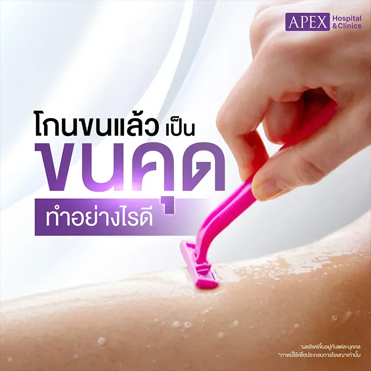 โกนขนแล้วเป็นขนคุด ผิวหนังไก่ รวมทุกสาเหตุและวิธีแก้อะไรบ้าง