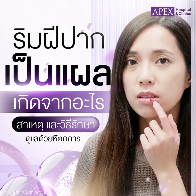 ริมฝีปากเป็นแผล สาเหตุเกิดจากอะไร วิธีการรักษาดูแลอย่างไร