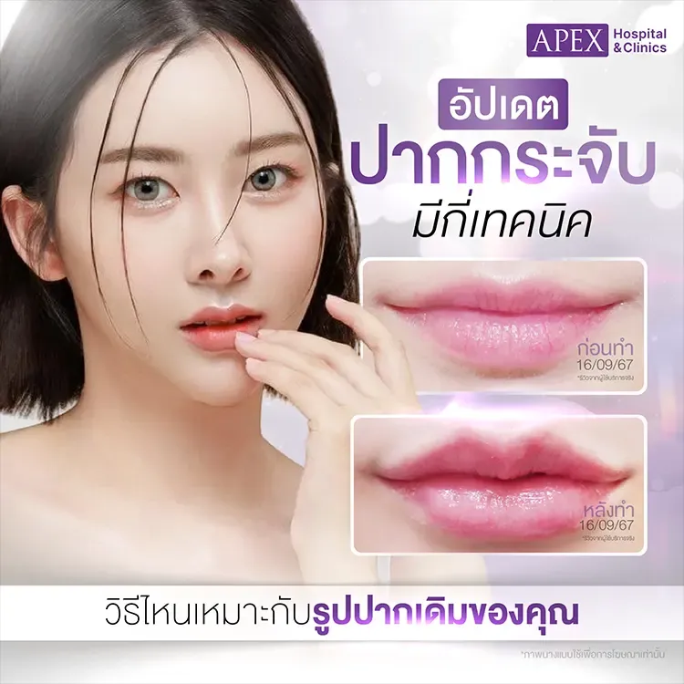 ปากกระจับ ลักษณะเป็นอย่างไร มีกี่แบบ ข้อควรระวังมีไหม