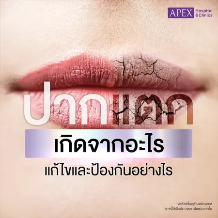 ปากแตกแห้งลอก สาเหตุเกิดจากอะไร วิธีการดูแลและป้องกันอย่างไร