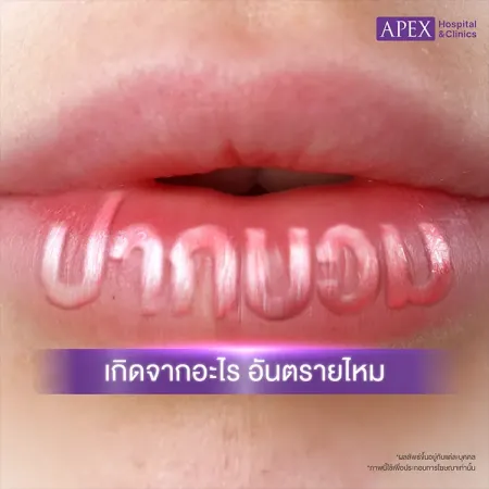 ปากบวม สาเหตุเกิดจากอะไร วิธีการดูแลและป้องกันอย่างไร