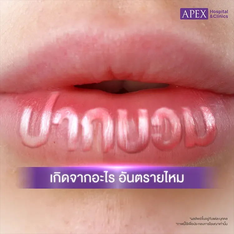 ปากบวม สาเหตุเกิดจากอะไร วิธีการดูแลและป้องกันอย่างไร