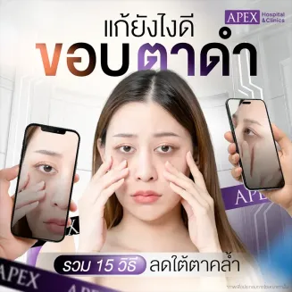 ขอบตาดำแก้ยังไง 15 วิธีบอกลาใต้ตาคล้ำ คืนความสดใสให้ใบหน้า