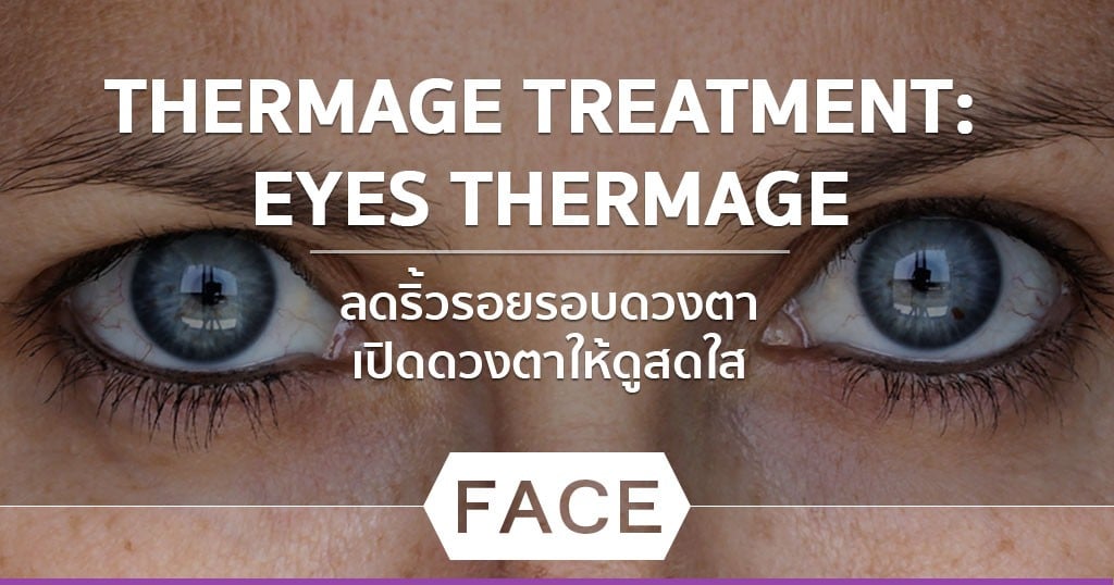 THERMAGE TREATMENT: EYES THERMAGE ลดริ้วรอยรอบดวงตา เปิดดวงตาให้ดูสดใส