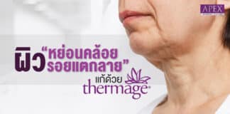 Reduce the sagging of the skin. in the face with Thermage
