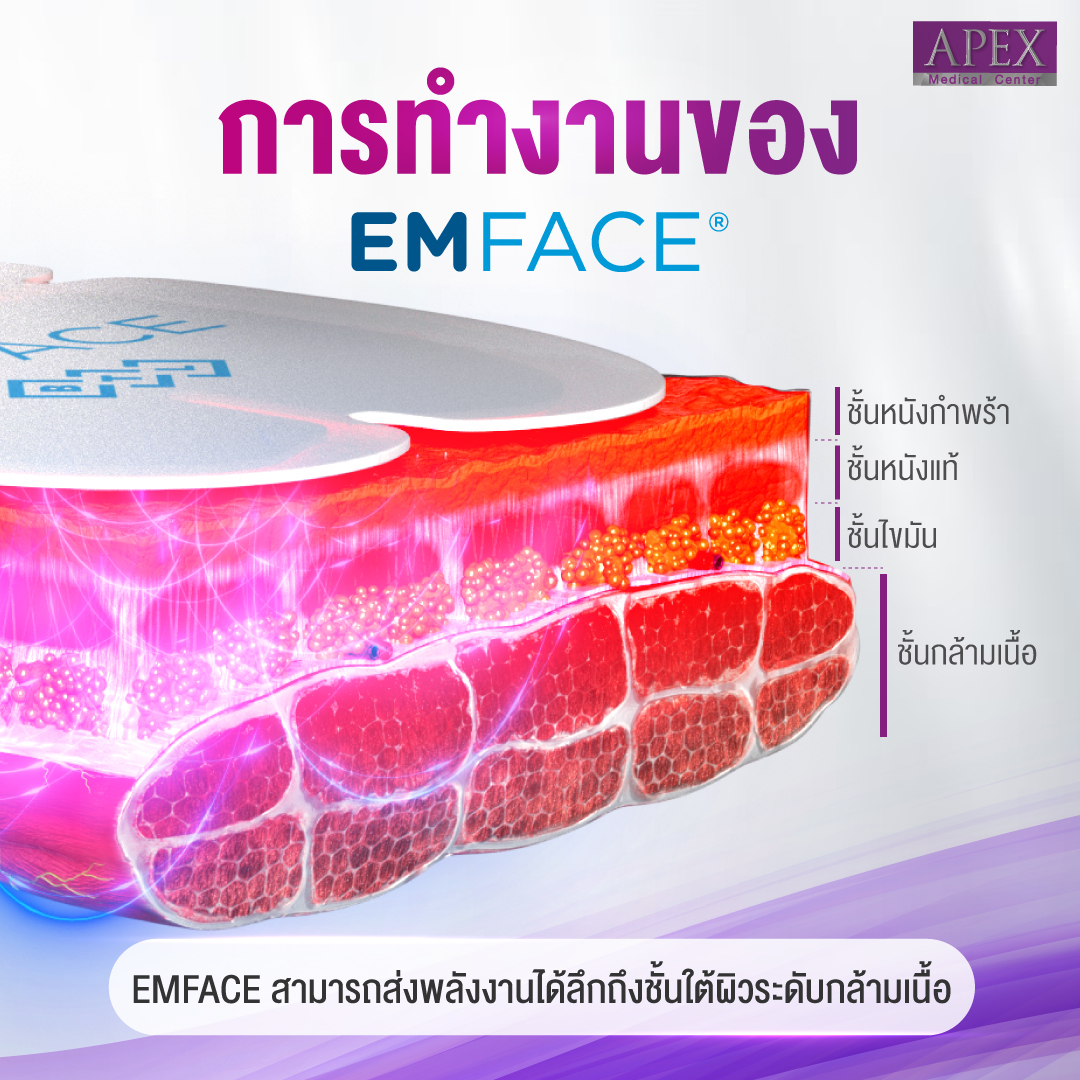 Apex , apexmedicalcenter , เอเพ็กซ์, เอเพ็กเมดิคอลเซ็นเตอร์, เสริมความงาม , คลินิกเสริมความงาม , Emface , emface ราคาเท่าไหร่ , emface ที่ไหนดี , emface ราคา , emface คืออะไร , emface รีวิว , emface เหมาะกับใคร , Emface Apex , Emface pantip , เครื่อง Emface , emface ราคาเท่าไหร่ , Emface2023 , Smile Lift, Smile Lift Apex ราคา , Smile Lift ที่ไหนดี , Smile Lift ราคา , Smile Lift รีวิว , Smile Lift Pantip , Smile Lift คือ , Smile Lift แก้ปัญหาร่องมุมปากลึก และมุมปากตก , Smile Lift2023 , Filler , ฟิลเลอร์ , การฉีดฟิลเลอร์ , ฟิลเลอร์ปาก , ฟิลเลอร์คาง , ฟิลเลอร์จมูก , ฟิลเลอร์ปากกระจับ , ฉีดฟิลเลอร์ปากกระจับ , ฉีดฟิลเลอร์ใต้ตา , ฉีดฟิลเลอร์ที่ไหนดี , ฉีดฟิลเลอร์ช่วยอะไร , ฉีดฟิลเลอร์2023