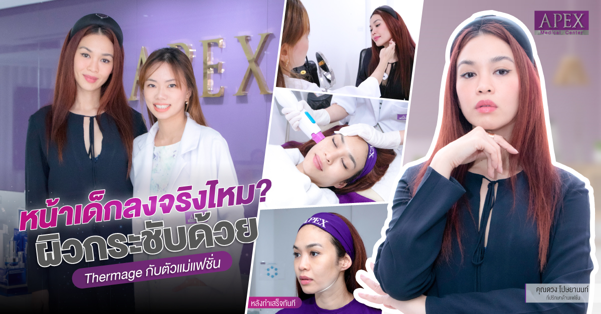 Thermage FLX make skin is firmer skin, clearer facial contours 