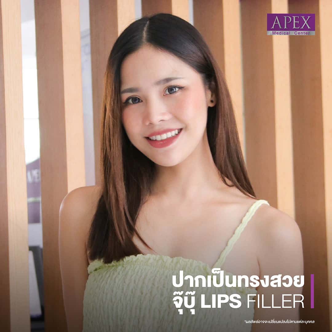 Lips Filler by APEX