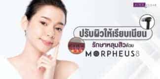 Morpheus8 is a non-surgical advanced needling treatment.
