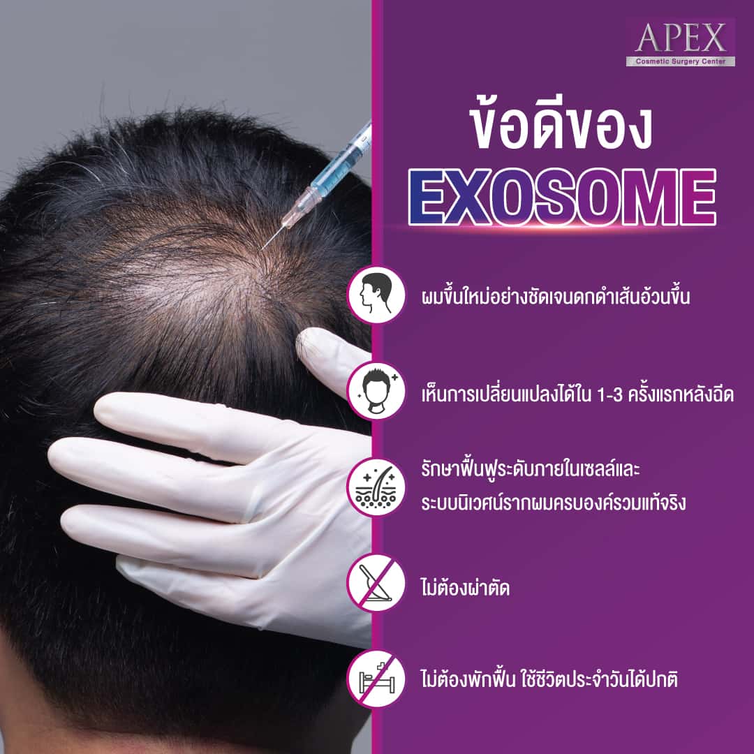 Exosome Hair