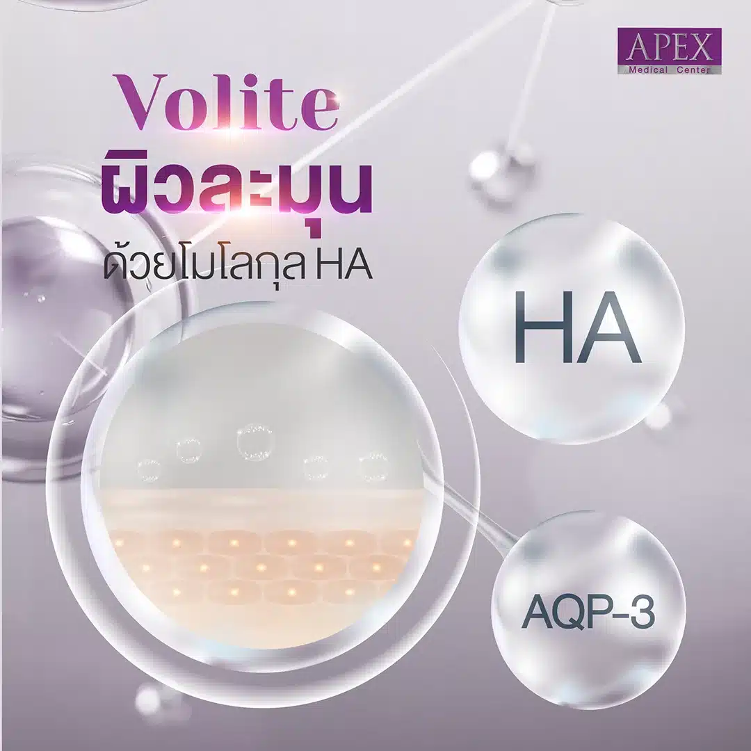 Volite is a type of Hyaluronic Acid (HA) Filler that is more special than previous fillers because Volite is designed to inject into the middle layer of the skin. Effectively directly add moisture to the dermis with hyaluronic acid that helps absorb water and retain moisture. [2]