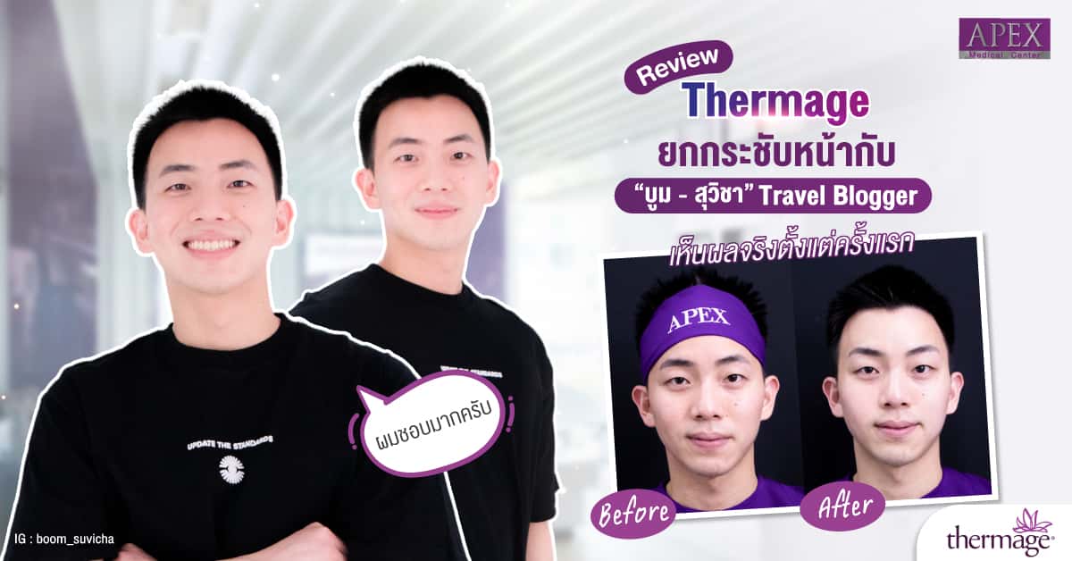 Review-Thermage FLX Thermage FLX, the latest innovation. Personalized face design by expert doctors