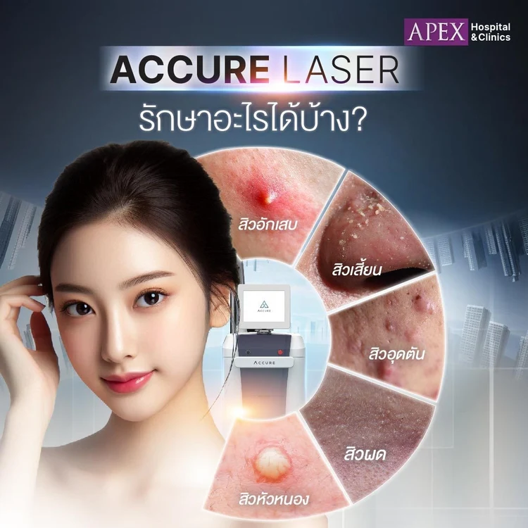 Accure Laser