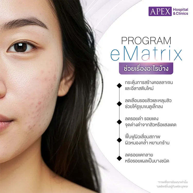 Ematrix ช่วยอะไรบ้าง