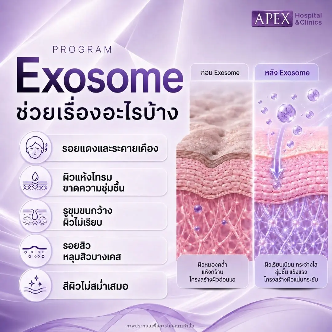 Exosome ช่วยอะไรบ้าง