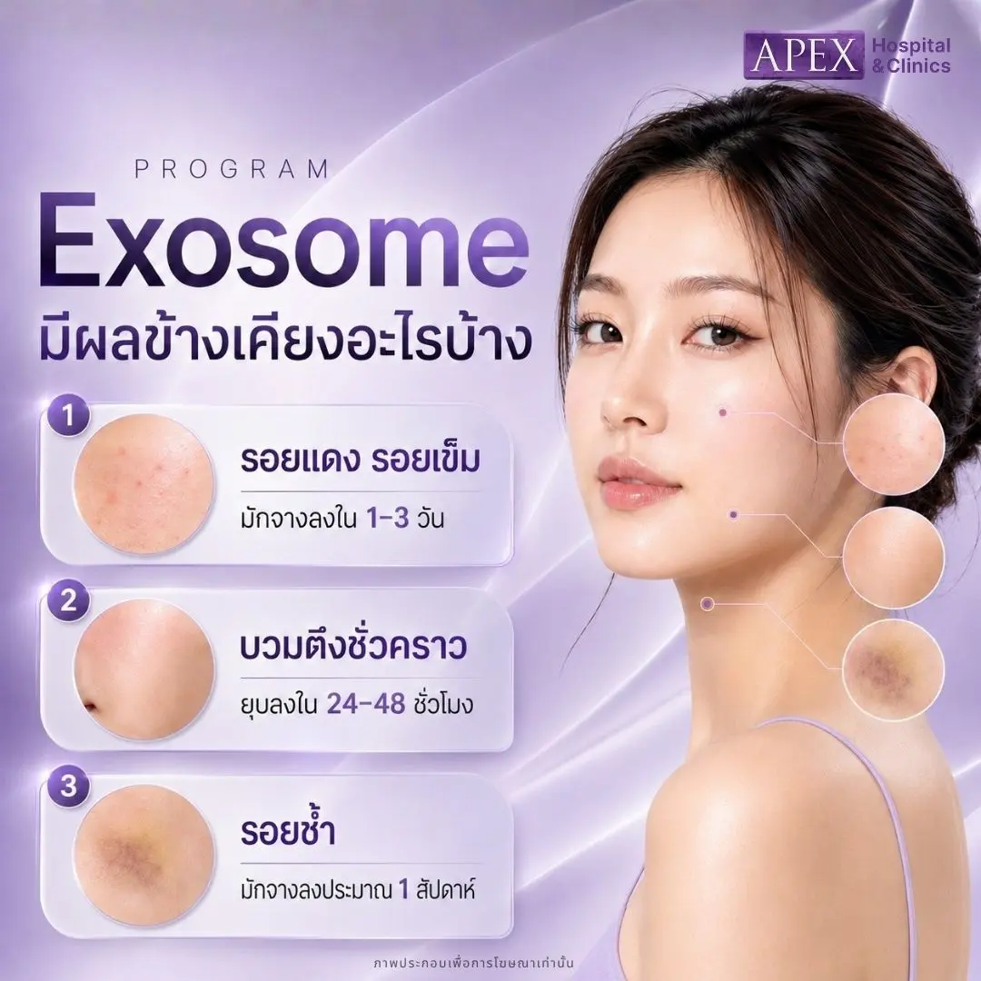 Exosome อันตรายไหม