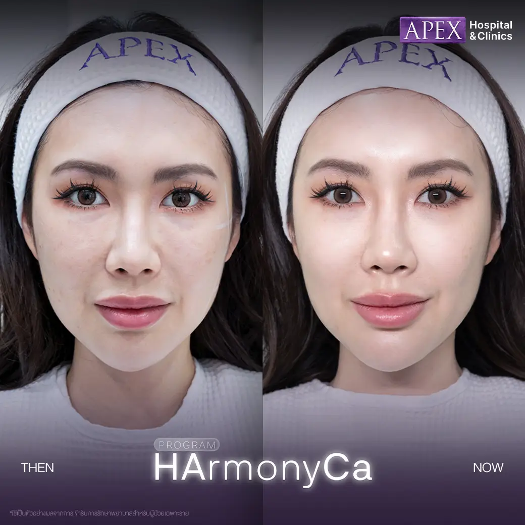 รีวิว HArmonyCa