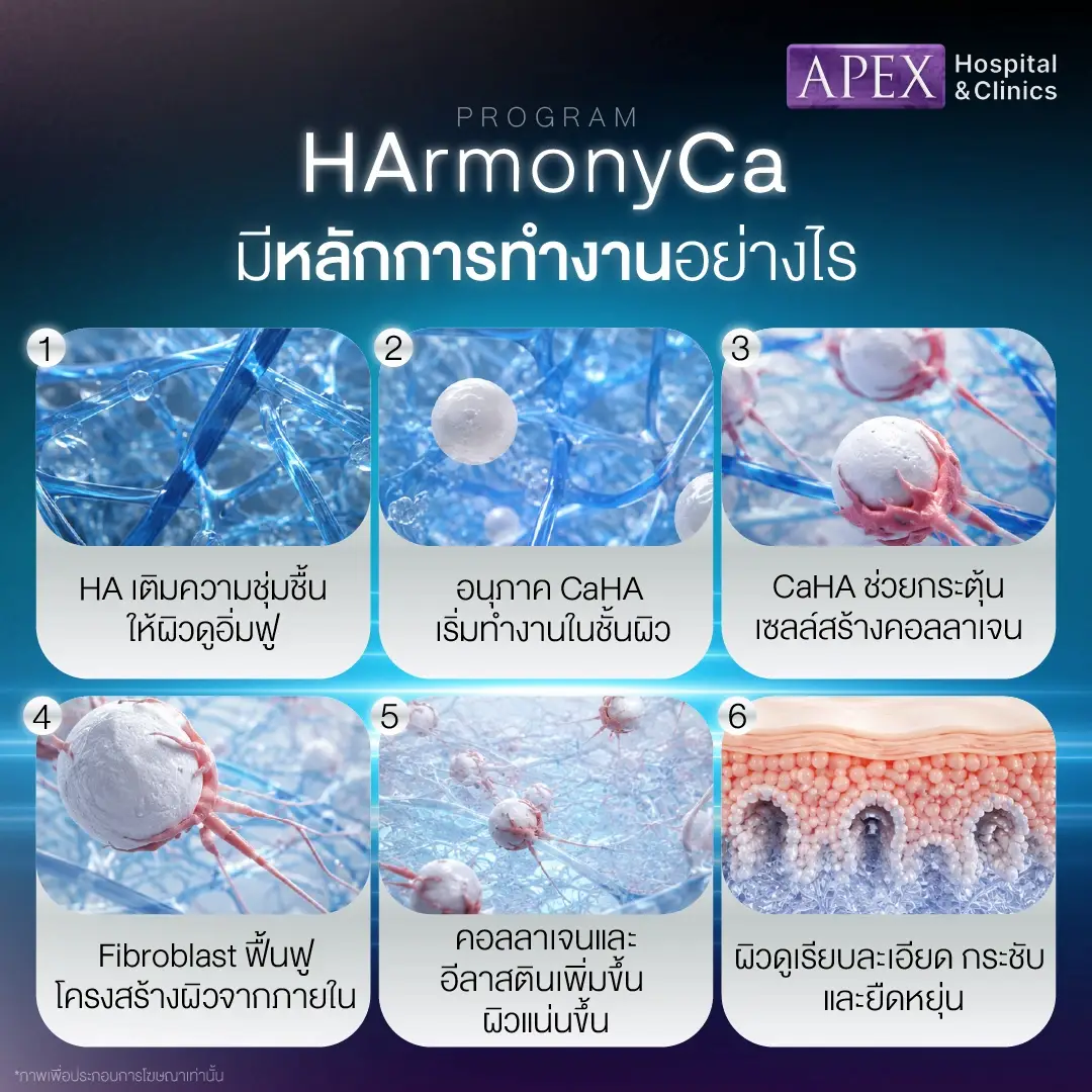HArmonyCa มีหลักการทำงานอย่างไร