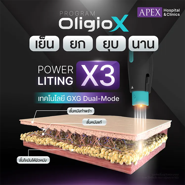 Oligio X จุดเด่น