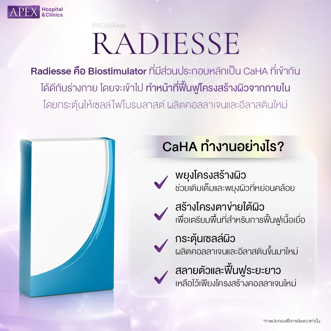 Radiesse มีหลักการทำงานอย่างไร