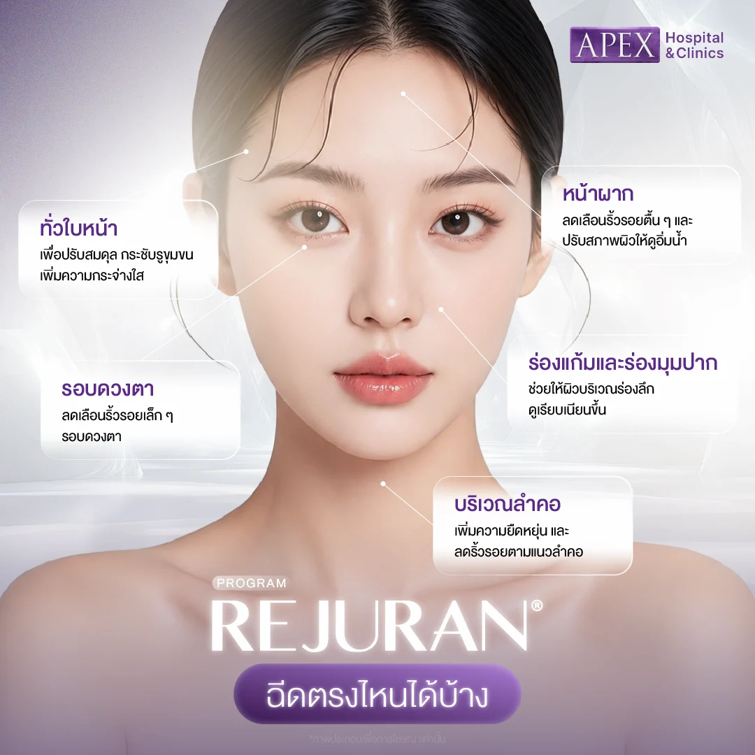 Rejuran ฉีดบริเวณไหนได้บ้าง