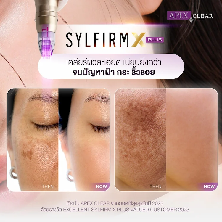 Sylfirm X Plus รีวิว