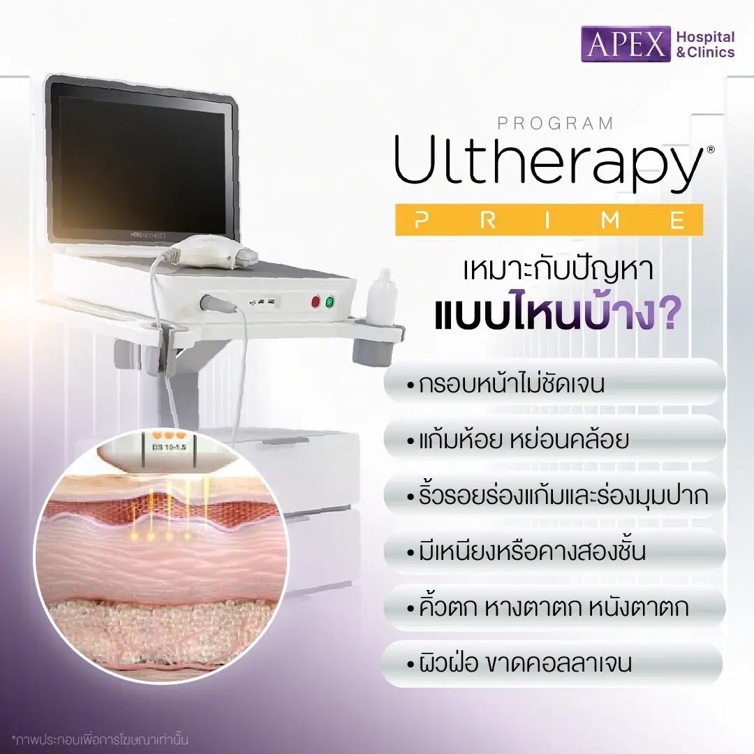 Ulthera Prime เหมาะกับใคร