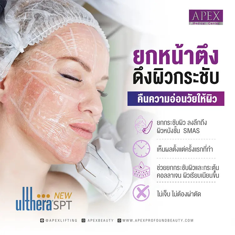 Ulthera ช่วยเรื่องอะไร