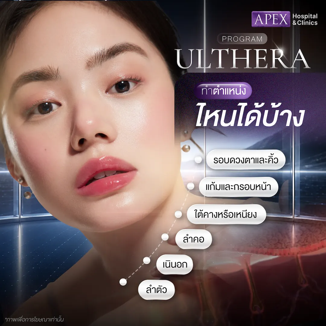 Ulthera ทำตำแหน่งไหนได้บ้าง