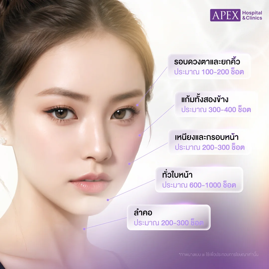 Ultraformer III ทำบริเวณไหนได้บ้าง