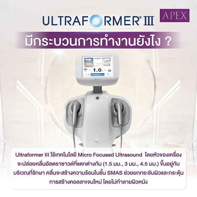 Ultraformer III มีหลักการทำงานอย่างไร