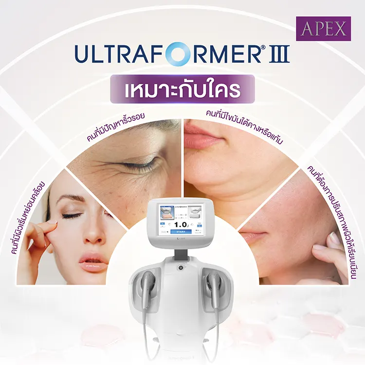 Ultraformer III เหมาะกับใคร