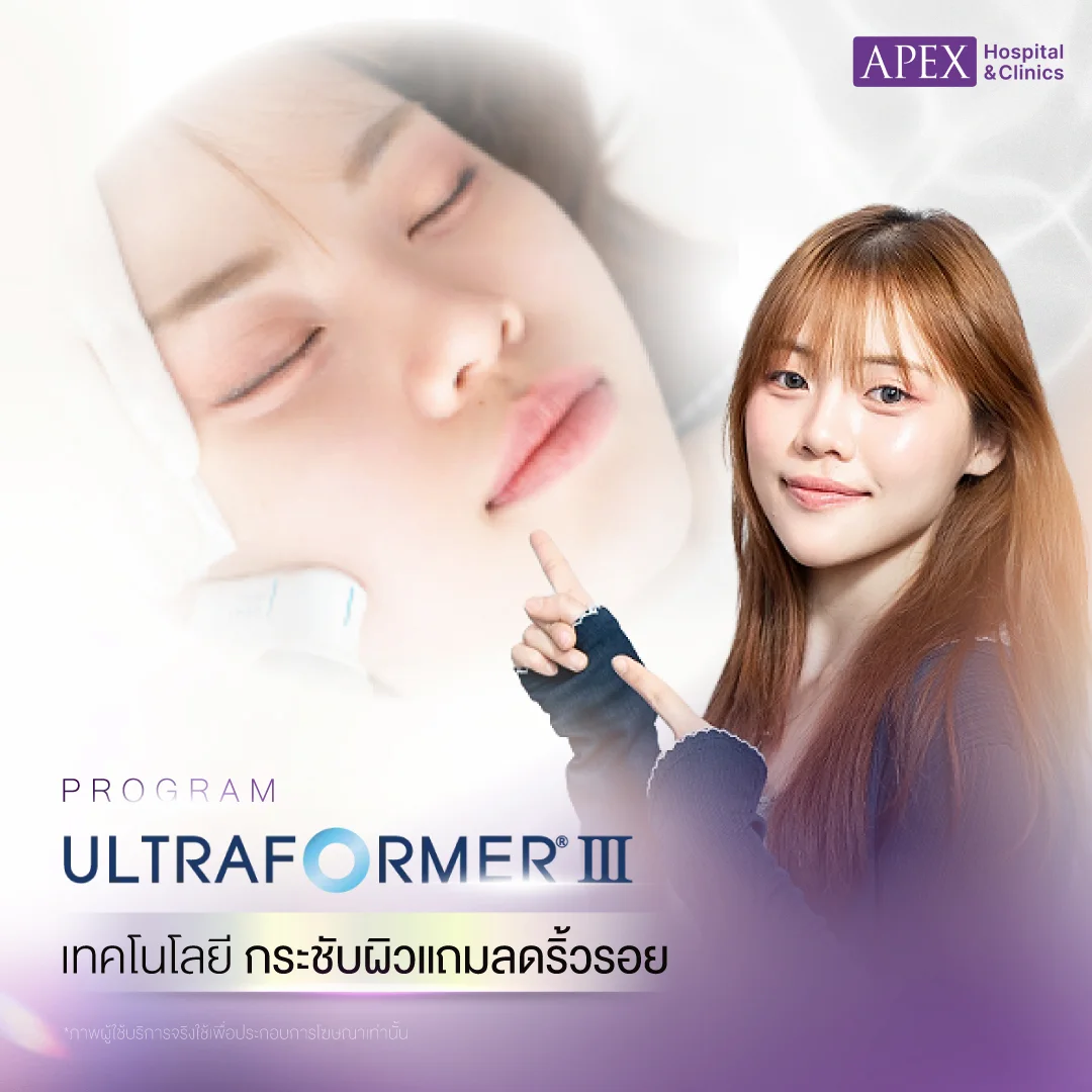 Ultraformer III คืออะไร ช่วยอะไร