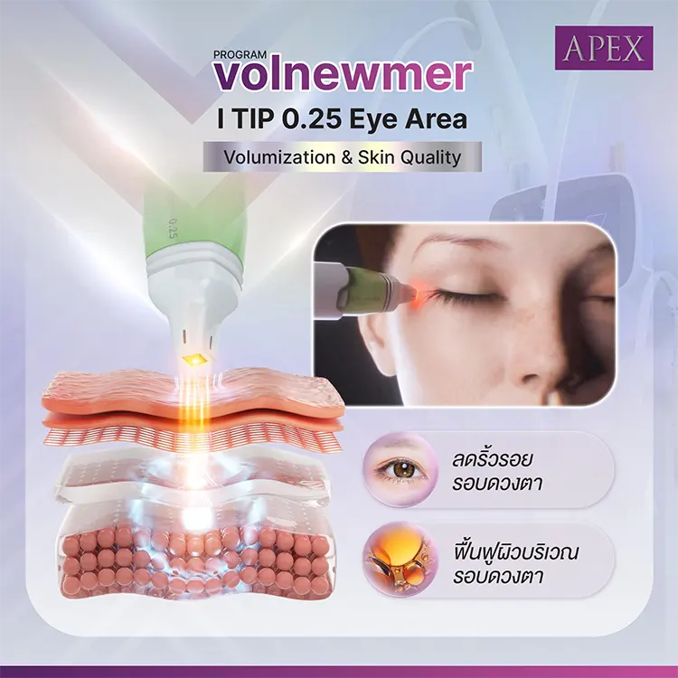 Volnewmer