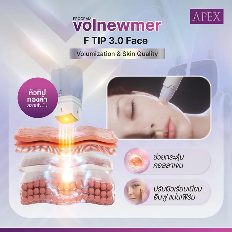Volnewmer