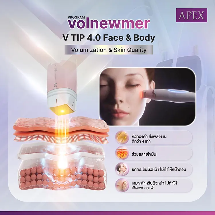 Volnewmer