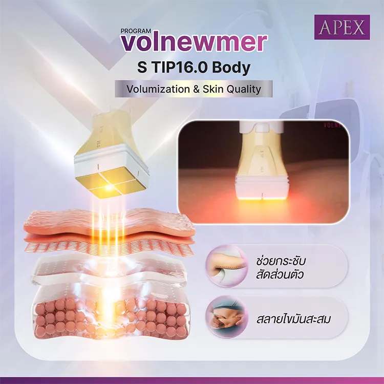 Volnewmer
