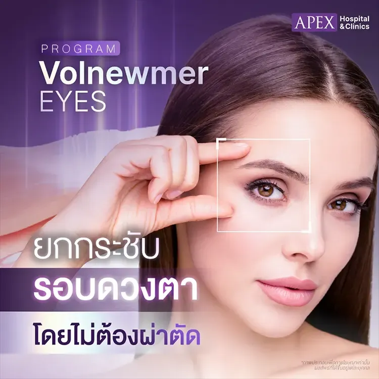 Volnewmer Eyes