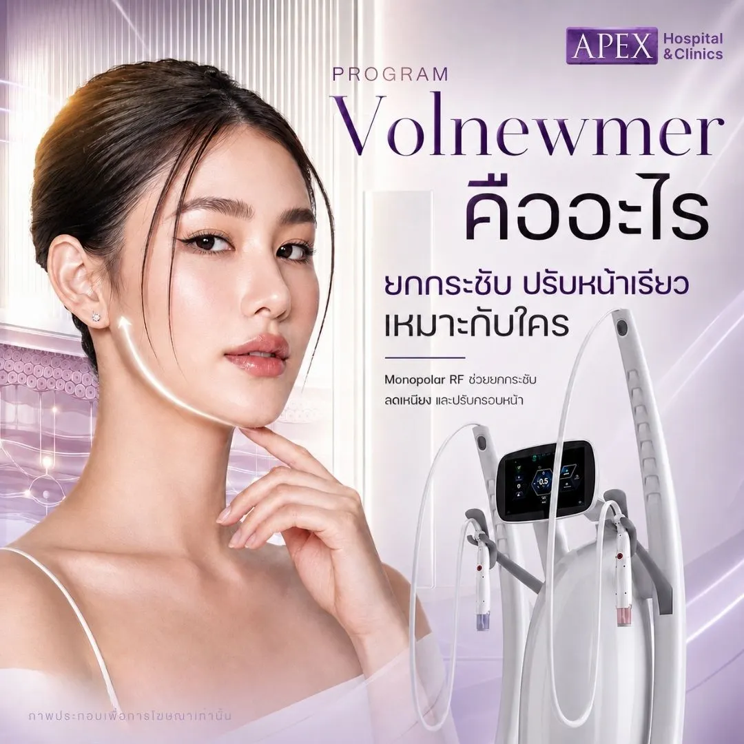 Volnewmer คืออะไร