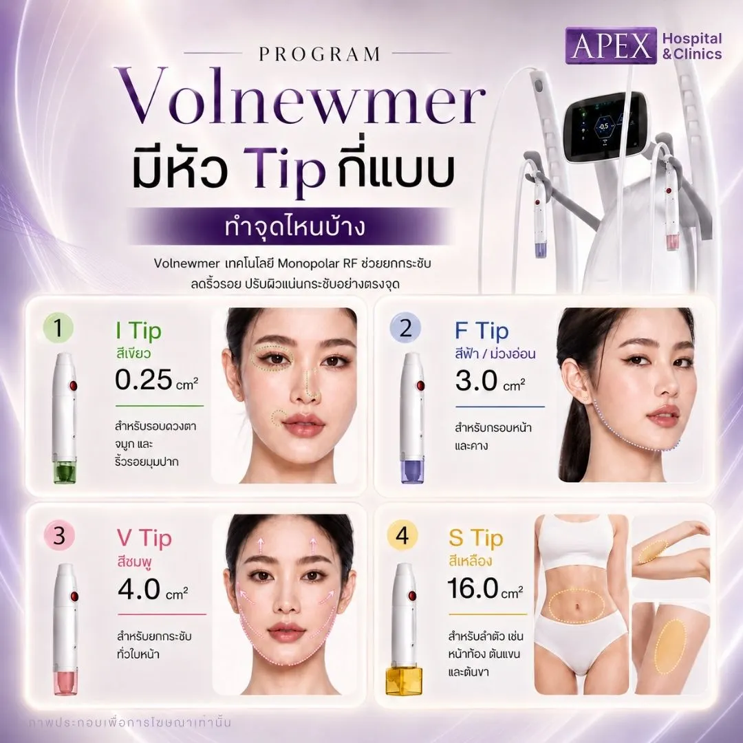 Volnewmer มีหัวทิปกี่แบบ