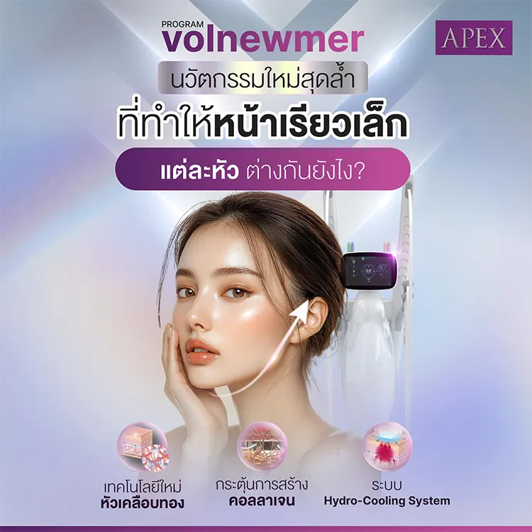 Volnewmer ความแตกต่าง หัว Tips