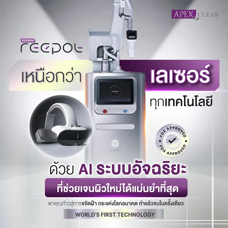 การทำงาน Reepot Laser