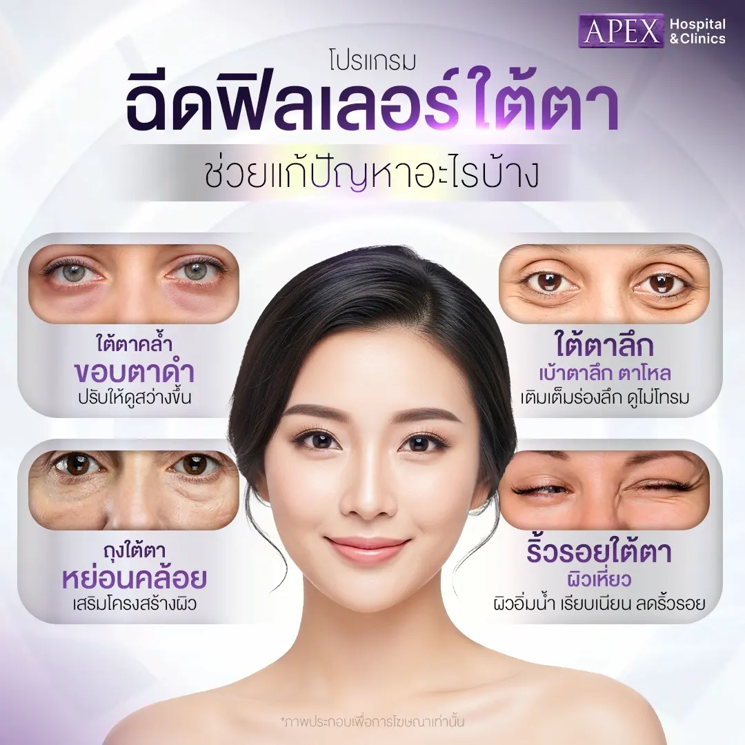 ข้อดีฟิลเลอร์ใต้ตา