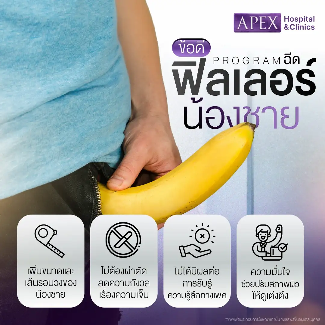 ข้อดีของฉีดฟิลเลอร์น้องชาย
